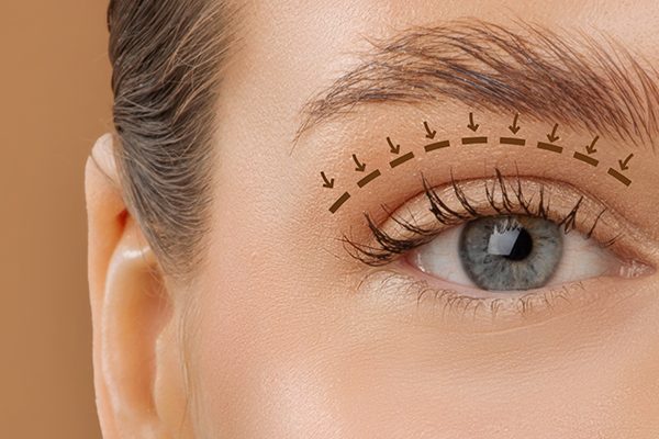 Eyelid Aesthetics