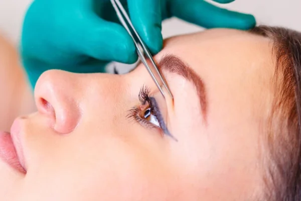 Upper Eyelid Surgery in Turkey