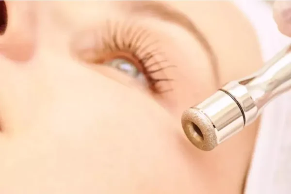 Dermabrasion